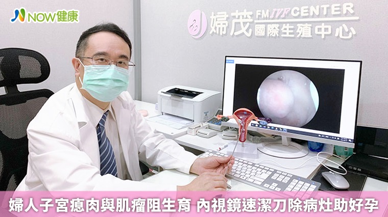 婦人子宮瘜肉與肌瘤阻生育 內視鏡速潔刀除病灶助好孕 婦人子宮瘜肉與肌瘤阻生育 內視鏡速潔刀除病灶助好孕