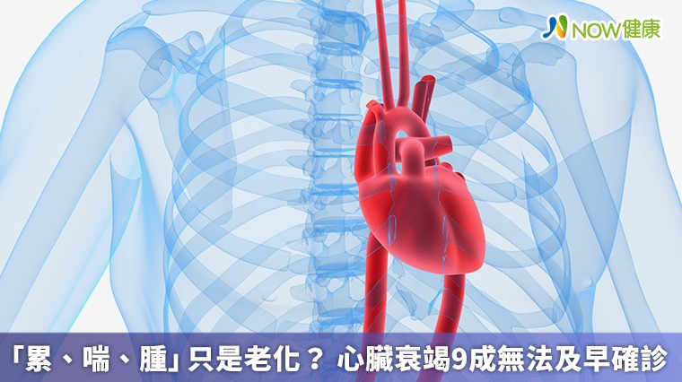 「累、喘、腫」只是老化? 心臟衰竭9成無法及早確診 「累、喘、腫」只是老化? 心臟衰竭9成無法及早確診