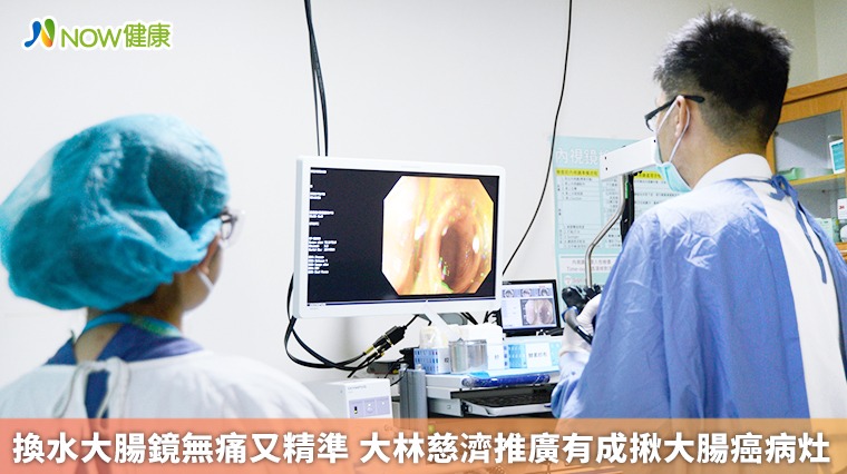 換水大腸鏡無痛又精準 大林慈濟推廣有成揪大腸癌病灶 換水大腸鏡無痛又精準 大林慈濟推廣有成揪大腸癌病灶