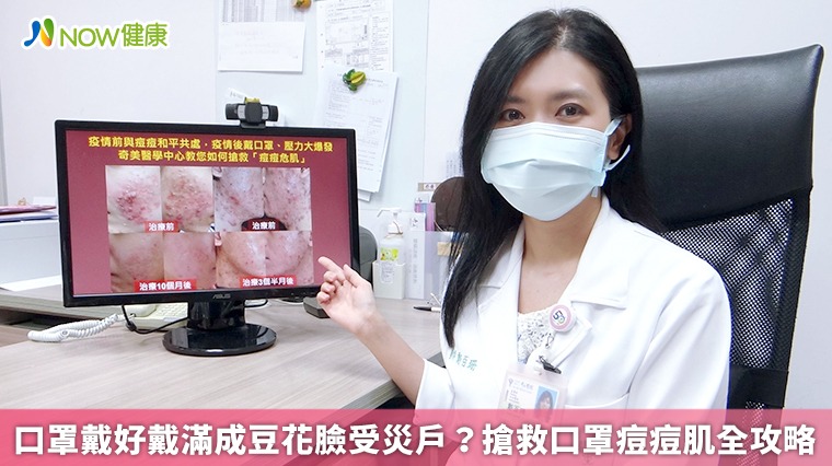 口罩戴好戴滿成豆花臉受災戶? 搶救口罩痘痘肌全攻略 口罩戴好戴滿成豆花臉受災戶? 搶救口罩痘痘肌全攻略