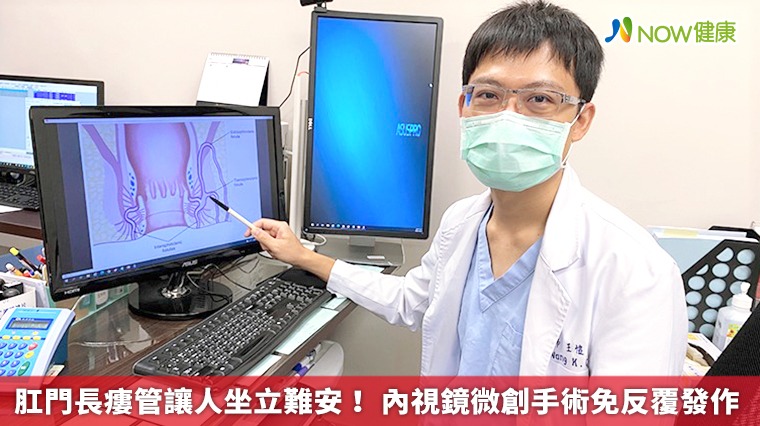 肛門長瘻管讓人坐立難安! 內視鏡微創手術免反覆發作 肛門長瘻管讓人坐立難安! 內視鏡微創手術免反覆發作