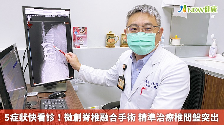 5症狀快看診!微創脊椎融合手術 精準治療椎間盤突出 5症狀快看診!微創脊椎融合手術 精準治療椎間盤突出