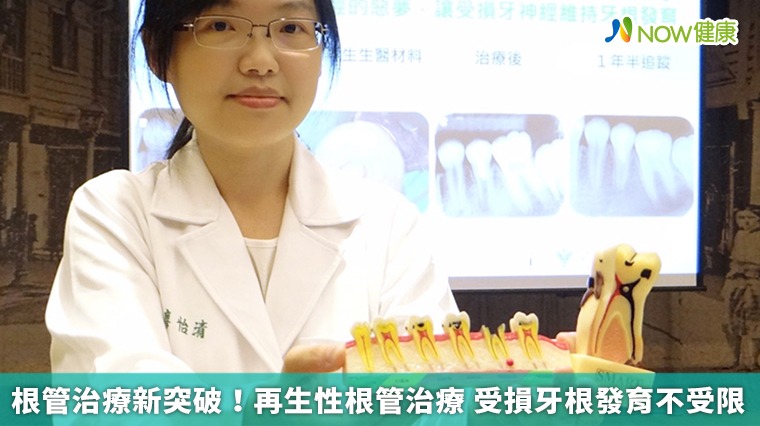 根管治療新突破!再生性根管治療 受損牙根發育不受限 根管治療新突破!再生性根管治療 受損牙根發育不受限