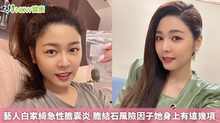藝人白家綺急性膽囊炎 膽結石風險因子她身上有這幾項 藝人白家綺急性膽囊炎 膽結石風險因子她身上有這幾項