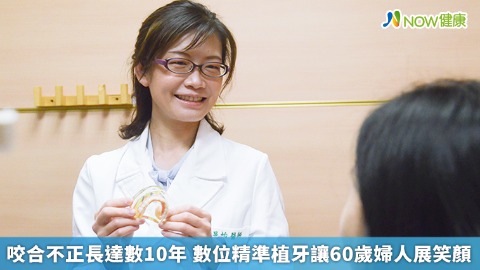 咬合不正長達數10年 數位精準植牙讓60歲婦人展笑顏