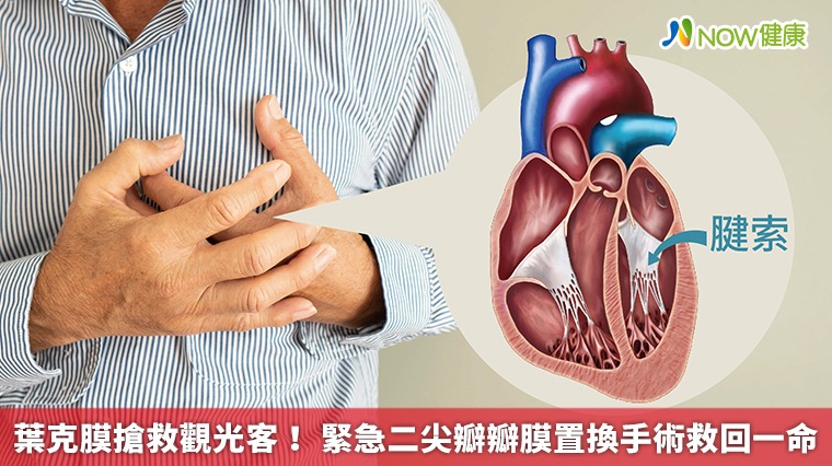 葉克膜搶救觀光客! 緊急二尖瓣瓣膜置換手術救回一命 葉克膜搶救觀光客! 緊急二尖瓣瓣膜置換手術救回一命