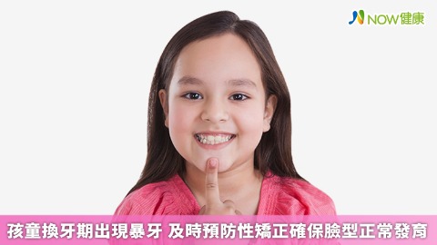 孩童換牙期出現暴牙 及時預防性矯正確保臉型正常發育