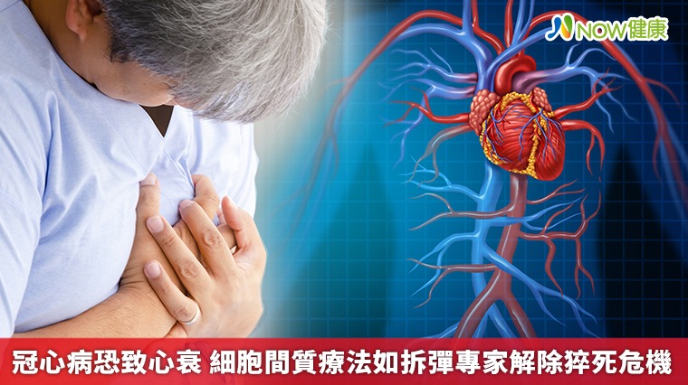 冠心病恐致心衰 細胞間質療法如拆彈專家解除猝死危機 冠心病恐致心衰 細胞間質療法如拆彈專家解除猝死危機