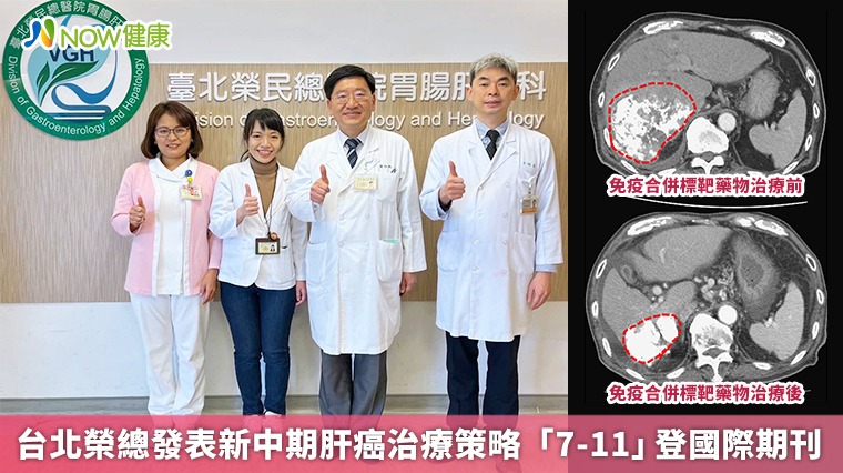 台北榮總發表新中期肝癌治療策略 「7-11」登國際期刊 台北榮總發表新中期肝癌治療策略 「7-11」登國際期刊