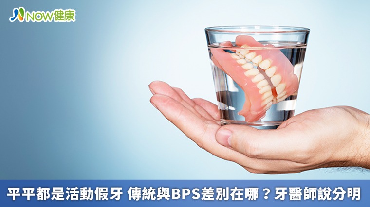 平平都是活動假牙 傳統與BPS差別在哪？牙醫師說分明