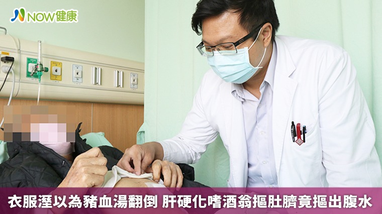 衣服溼以為豬血湯翻倒 肝硬化嗜酒翁摳肚臍竟摳出腹水 衣服溼以為豬血湯翻倒 肝硬化嗜酒翁摳肚臍竟摳出腹水