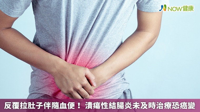 反覆拉肚子伴隨血便! 潰瘍性結腸炎未及時治療恐癌變 反覆拉肚子伴隨血便! 潰瘍性結腸炎未及時治療恐癌變