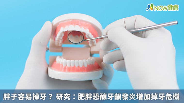 胖子容易掉牙? 研究:肥胖恐釀牙齦發炎增加掉牙危機 胖子容易掉牙? 研究:肥胖恐釀牙齦發炎增加掉牙危機
