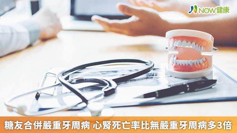 糖友合併嚴重牙周病 心腎死亡率比無嚴重牙周病多3倍 糖友合併嚴重牙周病 心腎死亡率比無嚴重牙周病多3倍