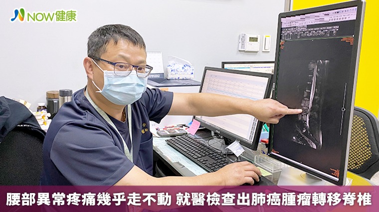 腰部異常疼痛幾乎走不動 就醫檢查出肺癌腫瘤轉移脊椎 腰部異常疼痛幾乎走不動 就醫檢查出肺癌腫瘤轉移脊椎