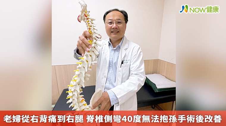 老婦從右背痛到右腿 脊椎側彎40度無法抱孫手術後改善 老婦從右背痛到右腿 脊椎側彎40度無法抱孫手術後改善