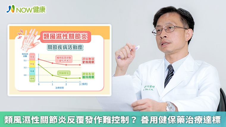 類風濕性關節炎反覆發作難控制？ 善用健保藥治療達標