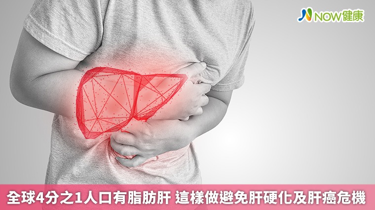 全球4分之1人口有脂肪肝 這樣做避免肝硬化及肝癌危機 全球4分之1人口有脂肪肝 這樣做避免肝硬化及肝癌危機