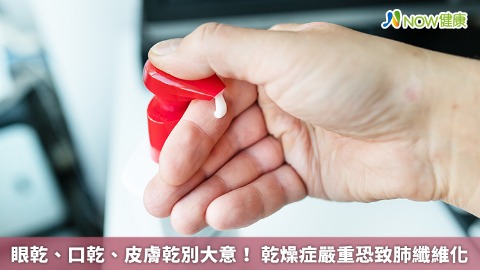 眼乾、口乾、皮膚乾別大意！ 乾燥症嚴重恐致肺纖維化