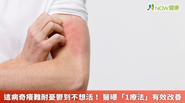 這病奇癢難耐憂鬱到不想活! 醫曝「1療法」有效改善 這病奇癢難耐憂鬱到不想活! 醫曝「1療法」有效改善