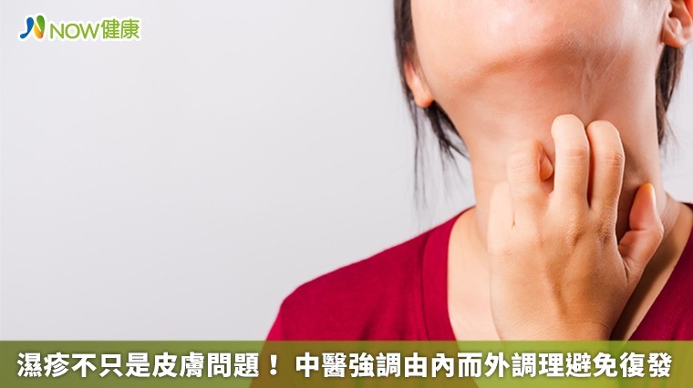 濕疹不只是皮膚問題! 中醫強調由內而外調理避免復發 濕疹不只是皮膚問題! 中醫強調由內而外調理避免復發