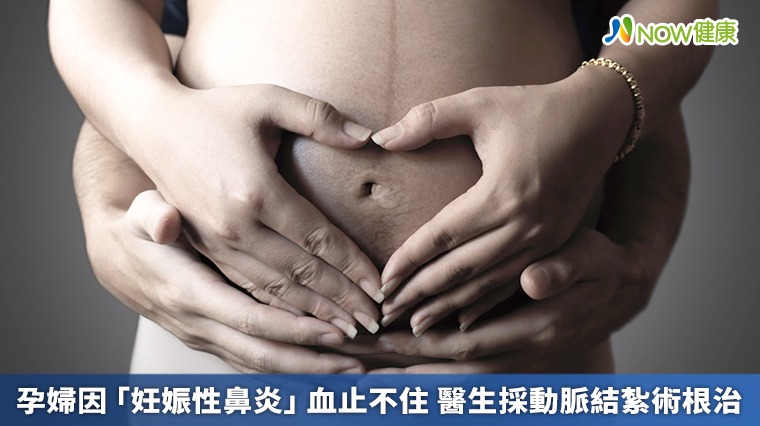 孕婦因「妊娠性鼻炎」血止不住 醫生採動脈結紮術根治 孕婦因「妊娠性鼻炎」血止不住 醫生採動脈結紮術根治