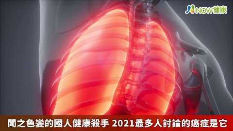 聞之色變的國人健康殺手 2021最多人討論的癌症是它