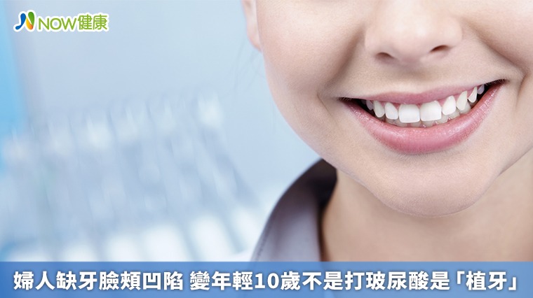 婦人缺牙臉頰凹陷 變年輕10歲不是打玻尿酸是「植牙」 婦人缺牙臉頰凹陷 變年輕10歲不是打玻尿酸是「植牙」