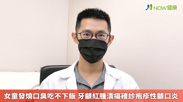 女童發燒口臭吃不下飯 牙齦紅腫潰瘍確診疱疹性齦口炎 女童發燒口臭吃不下飯 牙齦紅腫潰瘍確診疱疹性齦口炎