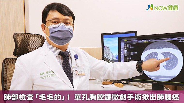 肺部檢查「毛毛的」! 單孔胸腔鏡微創手術揪出肺腺癌 肺部檢查「毛毛的」! 單孔胸腔鏡微創手術揪出肺腺癌