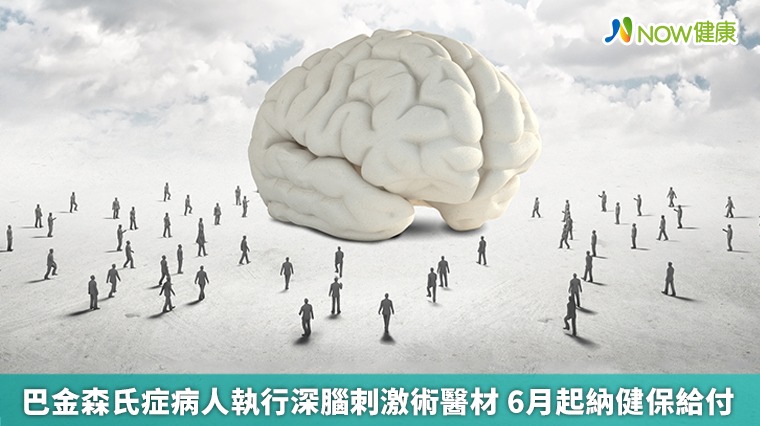 巴金森氏症病人執行深腦刺激術醫材 6月起納健保給付 巴金森氏症病人執行深腦刺激術醫材 6月起納健保給付