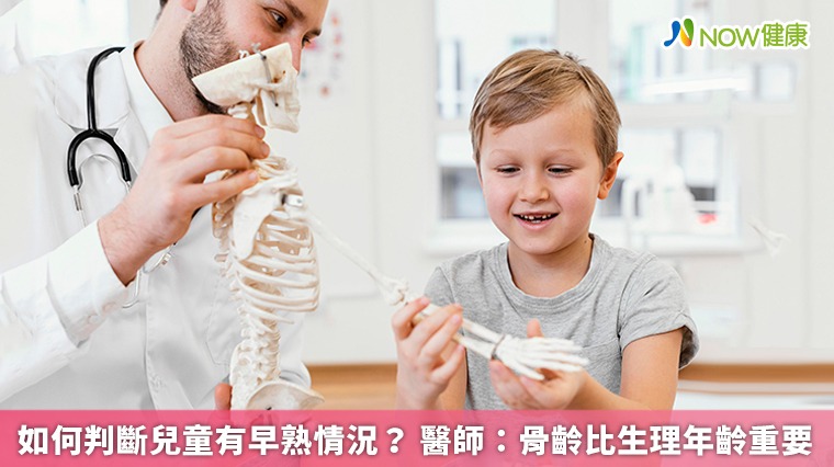 如何判斷兒童有早熟情況? 醫師:骨齡比生理年齡重要 如何判斷兒童有早熟情況? 醫師:骨齡比生理年齡重要