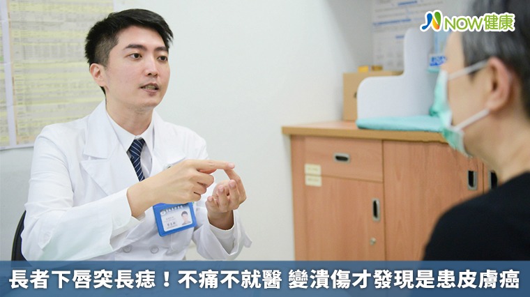 長者下唇突長痣!不痛不就醫 變潰傷才發現是患皮膚癌 長者下唇突長痣!不痛不就醫 變潰傷才發現是患皮膚癌