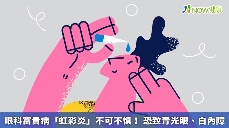 眼科富貴病「虹彩炎」不可不慎! 恐致青光眼、白內障 眼科富貴病「虹彩炎」不可不慎! 恐致青光眼、白內障