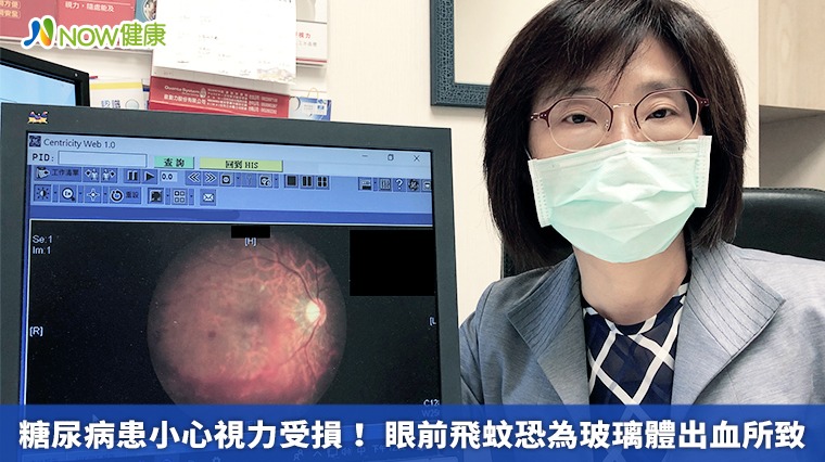 糖尿病患小心視力受損！ 眼前飛蚊恐為玻璃體出血所致