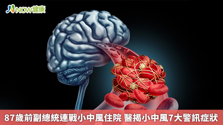 87歲前副總統連戰小中風住院 醫揭小中風7大警訊症狀 87歲前副總統連戰小中風住院 醫揭小中風7大警訊症狀