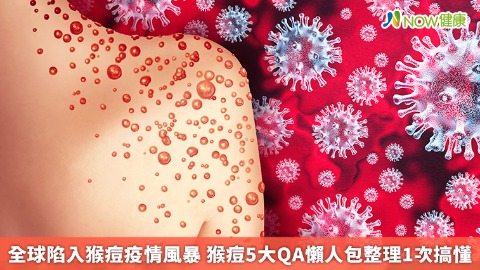 全球陷入猴痘疫情風暴 猴痘5大QA懶人包整理1次搞懂