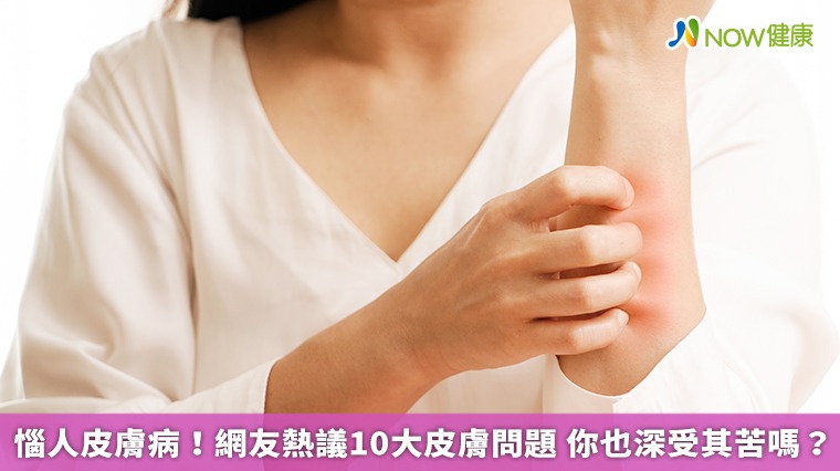 惱人皮膚病!網友熱議10大皮膚問題 你也深受其苦嗎? 惱人皮膚病!網友熱議10大皮膚問題 你也深受其苦嗎?