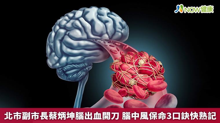 北市副市長蔡炳坤腦出血開刀 腦中風保命3口訣快熟記 北市副市長蔡炳坤腦出血開刀 腦中風保命3口訣快熟記