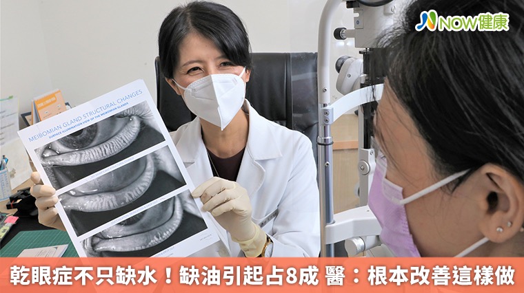 乾眼症不只缺水!缺油引起占8成 醫:根本改善這樣做 乾眼症不只缺水!缺油引起占8成 醫:根本改善這樣做
