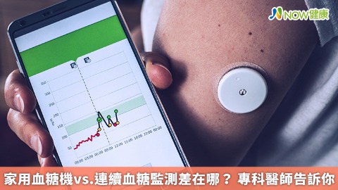 家用血糖機vs.連續血糖監測差在哪？ 專科醫師告訴你