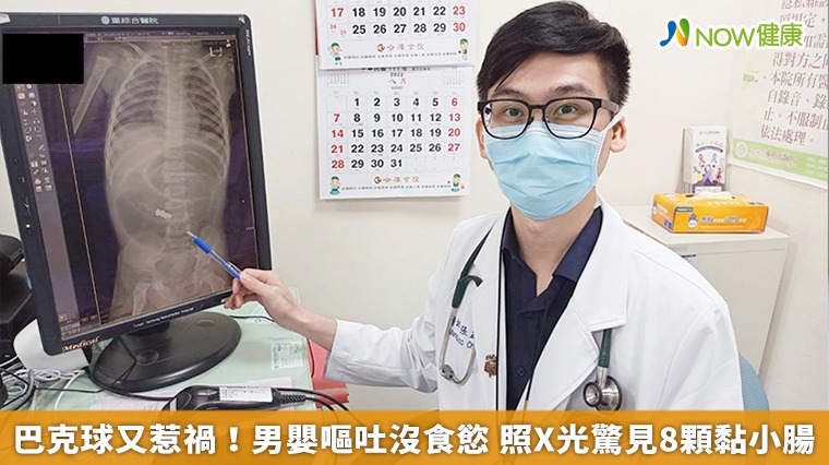 巴克球又惹禍！男嬰嘔吐沒食慾 照X光驚見8顆黏小腸