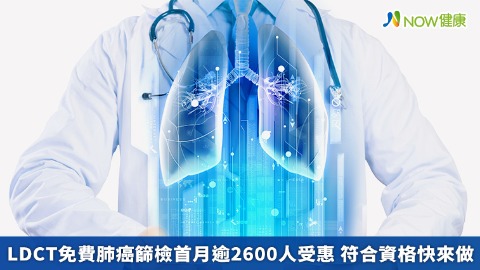 LDCT免費肺癌篩檢首月逾2600人受惠 符合資格快來做