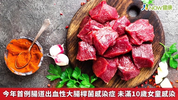 今年首例腸道出血性大腸桿菌感染症 未滿10歲女童感染 今年首例腸道出血性大腸桿菌感染症 未滿10歲女童感染