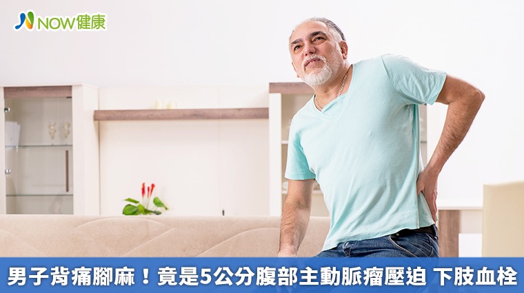 男子背痛腳麻 竟是5公分腹部主動脈瘤壓迫與下肢血栓 男子背痛腳麻 竟是5公分腹部主動脈瘤壓迫與下肢血栓