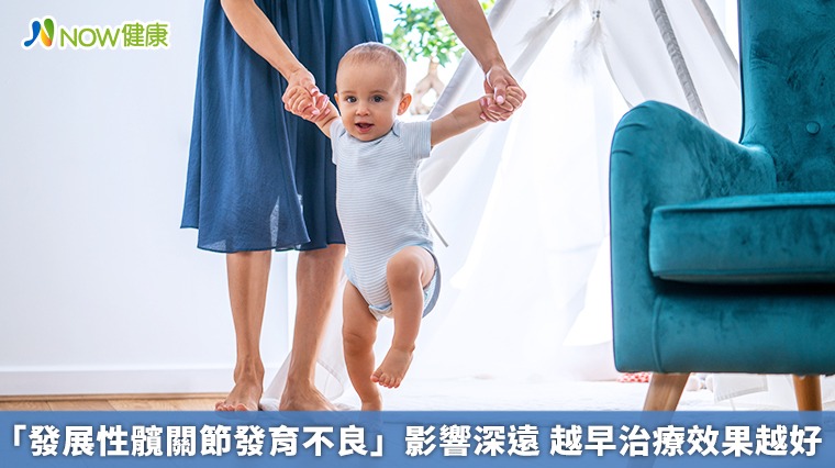 「發展性髖關節發育不良」影響深遠 越早治療效果越好 「發展性髖關節發育不良」影響深遠 越早治療效果越好