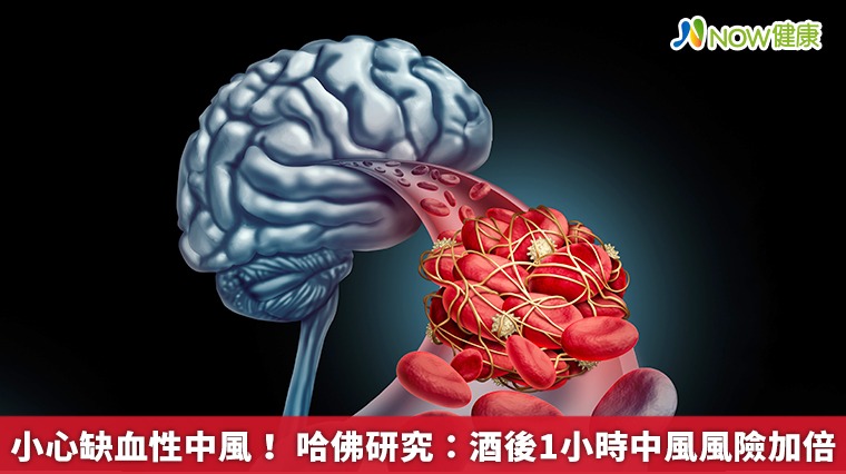 小心缺血性中風! 哈佛研究:酒後1小時中風風險加倍 小心缺血性中風! 哈佛研究:酒後1小時中風風險加倍
