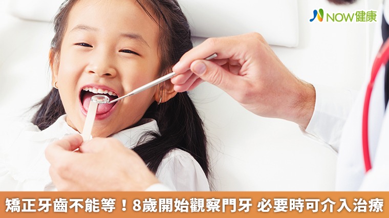 矯正牙齒不能等!8歲開始觀察門牙 必要時可介入治療 矯正牙齒不能等!8歲開始觀察門牙 必要時可介入治療