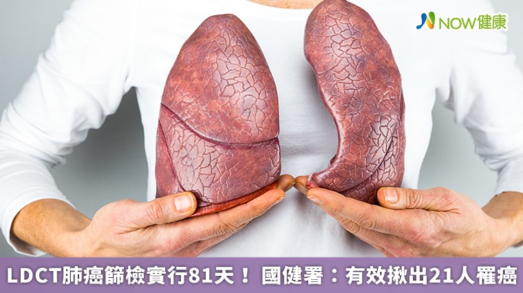 LDCT肺癌篩檢實行81天! 國健署:有效揪出21人罹癌 LDCT肺癌篩檢實行81天! 國健署:有效揪出21人罹癌