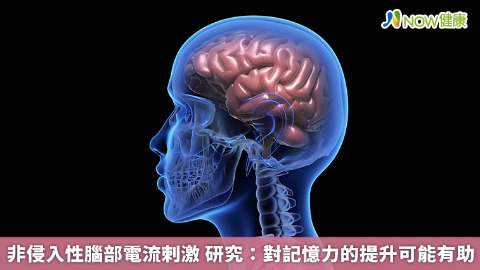 非侵入性腦部電流刺激 研究：對記憶力的提升可能有助